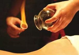 乳房上拔罐视频